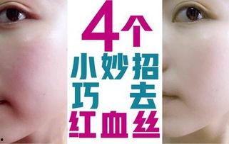 红血丝的视频,成因、影响及改善方法